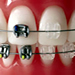 cirugia-dental